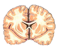 Thumbnail for version as of 19:20, 4 June 2026