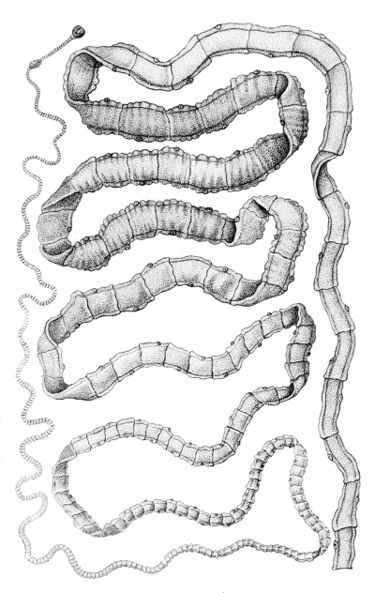 File:Taenia solium.jpg