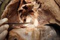 Photo of ductus thoracicus in human mediastinum