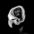 Neuroanatomy
