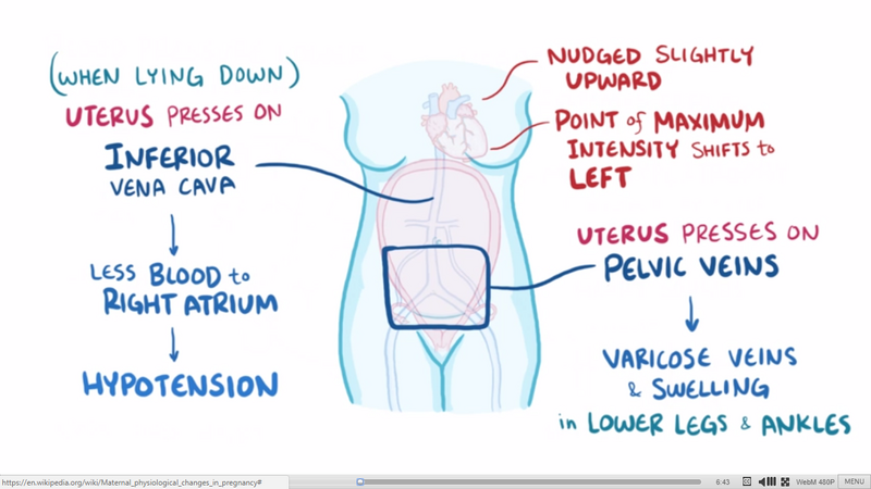 File:Pregnancy Uterus Compression of Structures.png