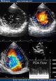 Thumbnail for version as of 13:40, 8 June 2026