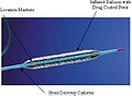Taxus stent used in cardiology