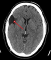Thumbnail for version as of 02:11, 7 June 2026