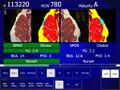 Thumbnail for version as of 01:20, 2 June 2026