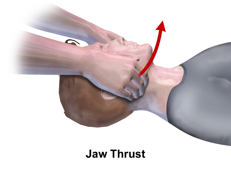 File:CPR Adult Jaw Thrust.png