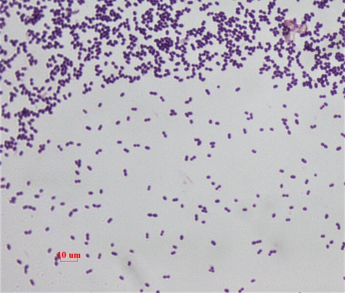 File:Enterococcus faecalis.jpg