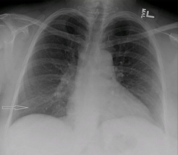 File:Cureus-0011-00000004559-i03.jpg