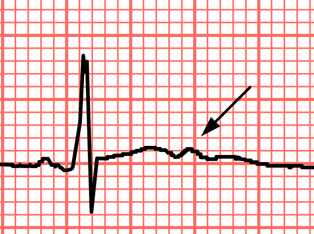 File:U wave.svg
