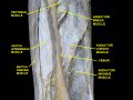Vastus intermedius in dissection