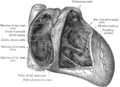 Pulmonary valve