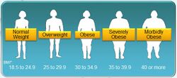 BMI scale