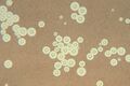 Cryptococcus