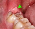 Thumbnail for version as of 03:34, 5 June 2026