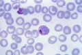 Gametocyte