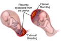 Thumbnail for version as of 01:22, 2 June 2026