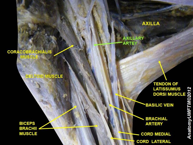 File:Slide9JJJ.JPG