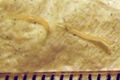 Threadworm