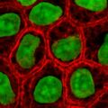 Epithelial cells showing intermediate filaments