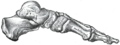 Köhler disease