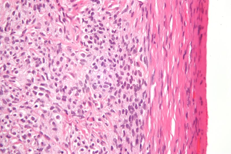 File:Thecoma high mag.jpg