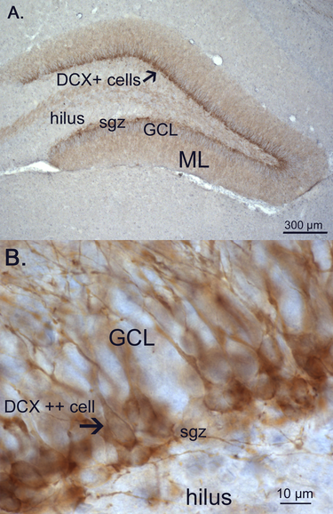 File:Doublecortin expression.png