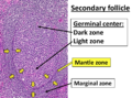Dark, light, mantle and marginal zones of a secondary follicle