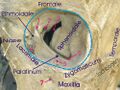 Human skull orbit showing infraorbital foramen