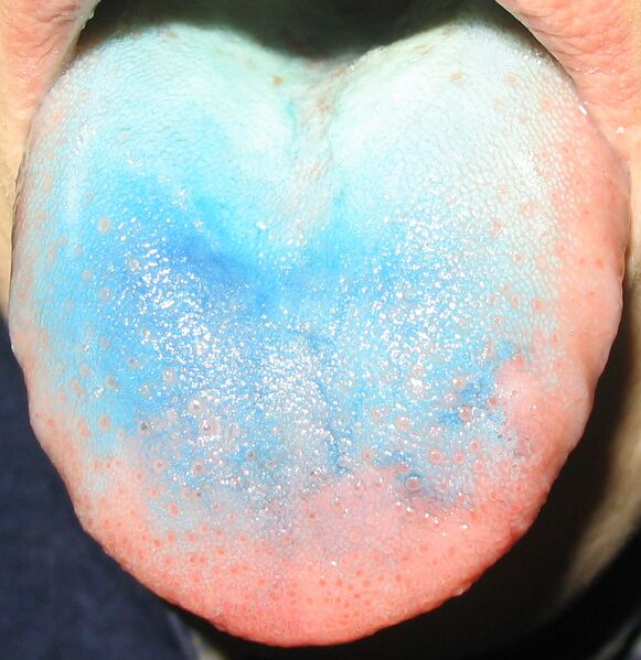 File:Blue tongue.jpg