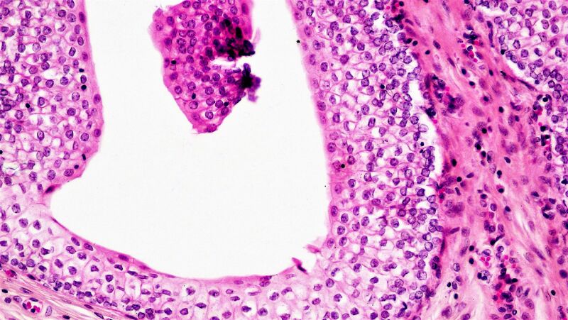 File:Epithelial Tissues Transitional (27025224337).jpg
