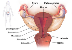 Typical Sites for Pelvic Inflammatory Disease.