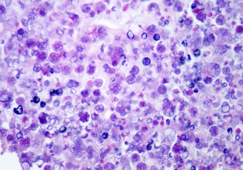 File:Prototheca wickerhamii.hematoxylin eosin stain.jpg