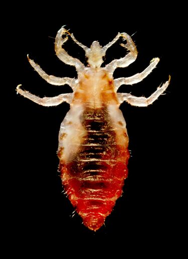File:Body lice.jpg