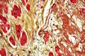 Movat's stain