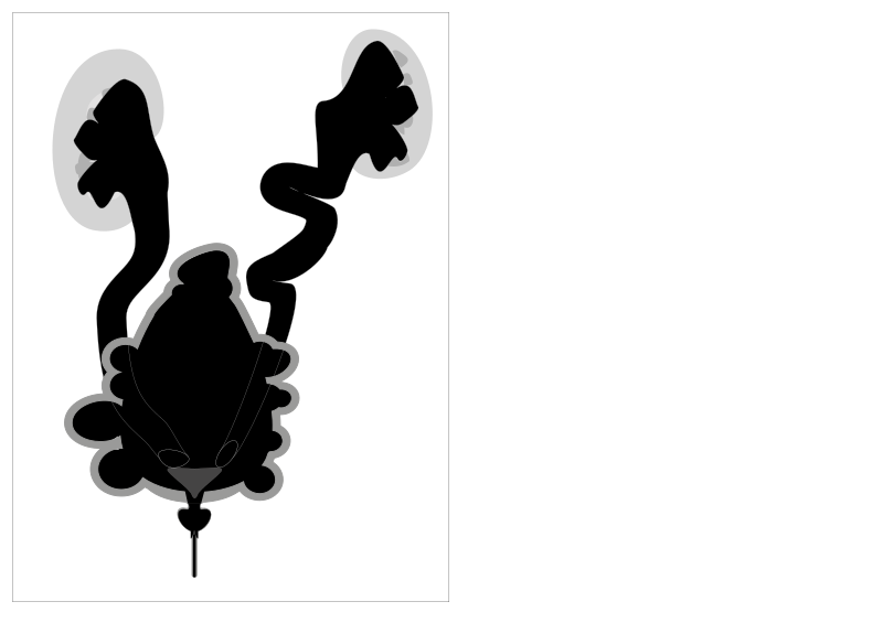 File:Posterior Urethral Valve.svg