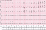 Thumbnail for version as of 03:36, 5 June 2026