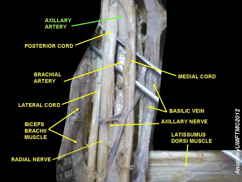 File:Slide11OOO.JPG