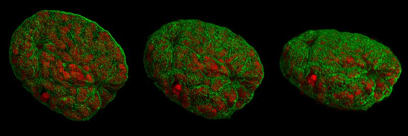 File:3D-SIM-2 Nucleus prophase 3d rotated.jpg