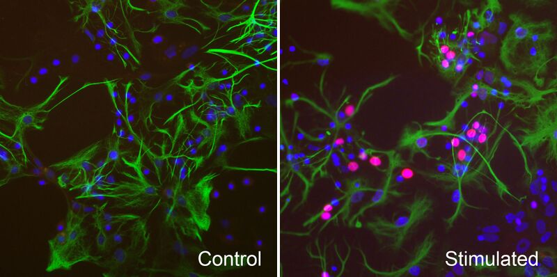 File:CFos-expression-in-stimulated-neurons.jpg