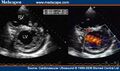 Thumbnail for version as of 13:40, 8 June 2026