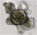 Organoid