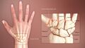 3D medical animation of human wrist showing carpal bones
