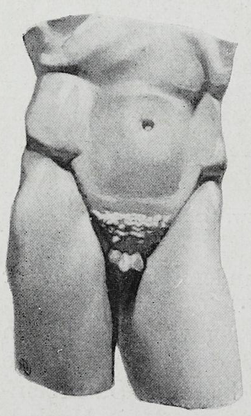 File:Braus 1921 102.png
