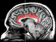 Thumbnail for version as of 00:05, 8 June 2024