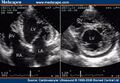 Thumbnail for version as of 13:37, 8 June 2026