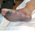 Thumbnail for version as of 09:20, 30 May 2026