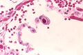 Cytomegalovirus 01