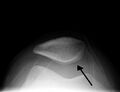 Thumbnail for version as of 03:20, 5 June 2026