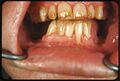 Thumbnail for version as of 03:36, 5 June 2026