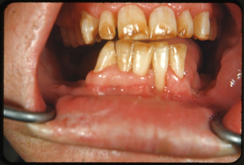 File:4724507933 07ac954c27 bFluorose.jpg